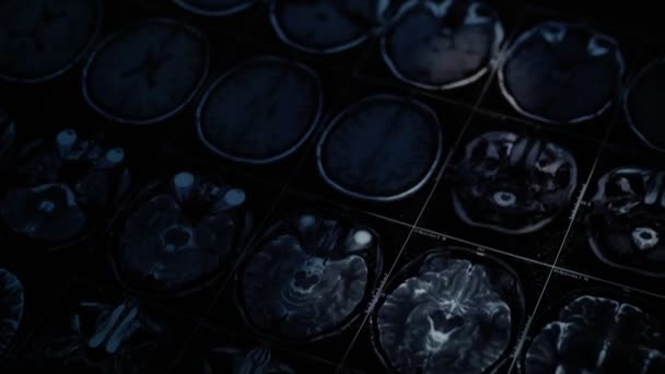 Concept Oncologische patiënt, kale vrouw en arts man bekijken tomografie resultaten op zwarte achtergrond. — Stockvideo