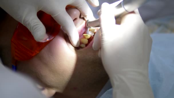 Cerca. un dentista manos en guantes examinar un hombre dientes — Vídeo de stock