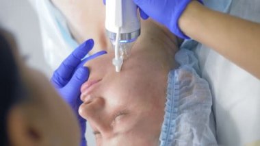 Güzellik kliniğinde yüz gerdirme ameliyatı için iğne kesiti Rf.