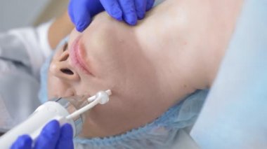 Güzellik kliniğinde yüz gerdirme ameliyatı için iğne kesiti Rf.