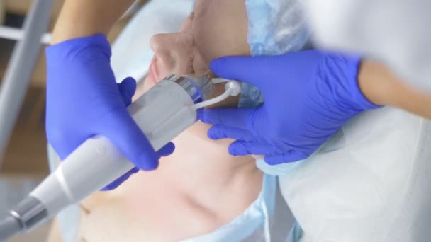 Procedimiento RF fraccional de la aguja para el levantamiento de la cara en una clínica de belleza . — Vídeos de Stock