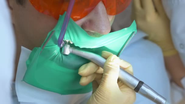 Närbild. läkare tandläkare behandlar tänder patient man använder cofferdam — Stockvideo