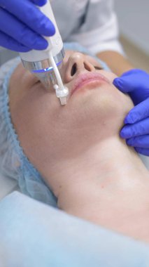 Güzellik kliniğinde yüz gerdirme ameliyatı için iğne kesiti Rf.