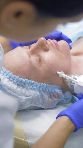 Procedimiento RF fraccional de la aguja para el levantamiento de la cara en una clínica de belleza . — Foto de Stock