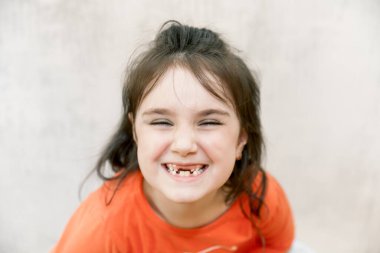 Kızgın gülüşü ve beyaz arka planda ön süt dişlerini kaçıran saldırgan, yaramaz kızın komik yakın plan portresi.