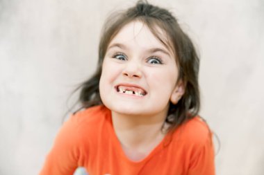 Kızgın gülüşü ve beyaz arka planda ön süt dişlerini kaçıran saldırgan, yaramaz kızın komik yakın plan portresi.