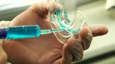 Klinik diş beyazlatma. Doktor dişlik beyazlatma kompozisyon ile doldurur..