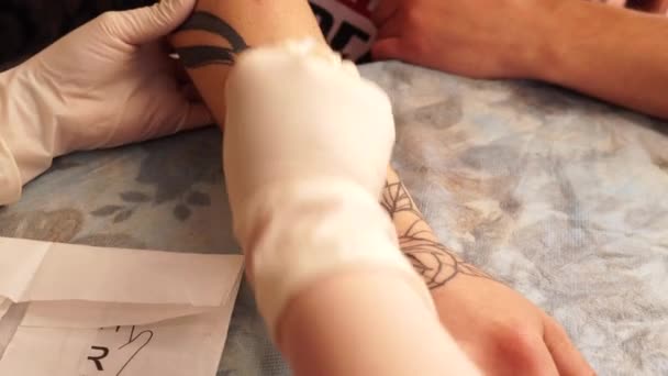 Láser de eliminación de tatuajes. Una joven se quita el tatuaje con un láser . — Vídeo de stock