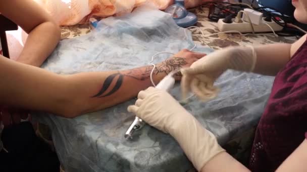 Tätowierlaser. ein junges Mädchen entfernt die Tätowierung mit einem Laser. — Stockvideo