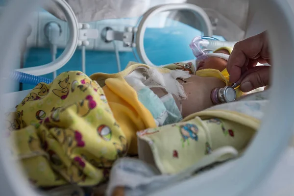 Un bebé prematuro en una incubadora en la unidad de cuidados intensivos en el hospital de maternidad en Kramatorsk, región de Donetsk, Ucrania — Foto de Stock