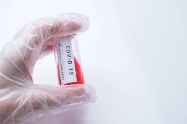 Doktor içinde kan olan bir test tüpü tutuyor. Yeni bir koronovirüs ile enfeksiyon testi. Çin 'in yeni virüsü 2019-nCoV