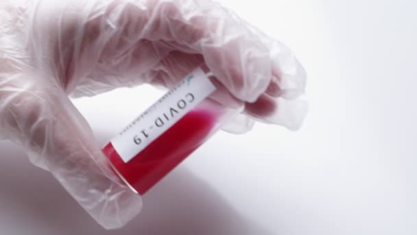 De dokter houdt een reageerbuis met bloed vast. Test op infectie met een nieuw coronovirus. Chinas nieuw virus genaamd 2019-nCoV — Stockvideo