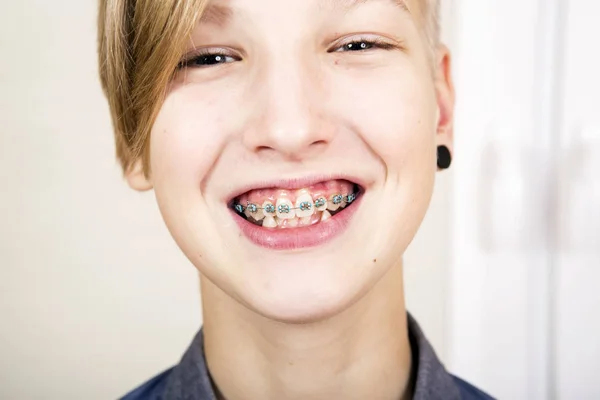 Orthodontie et correction des morsures . — Photo