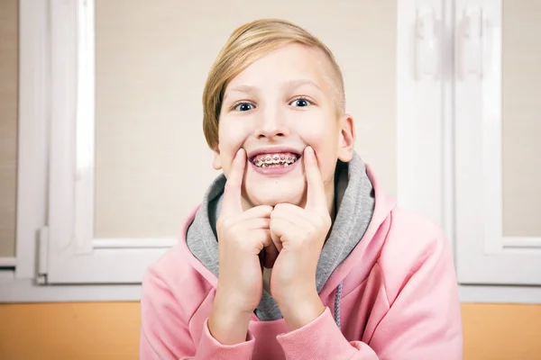 Ortodoncja i bite korekcji. — Zdjęcie stockowe