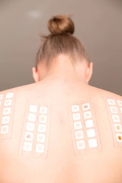 Allergy skin test — Stock Photo, Image