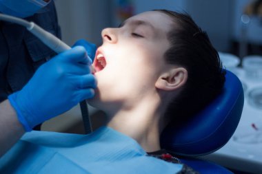 Bir genç olarak diş hekimliği diş hekimleri randevu açık ağzı ile. Diş tedavisi.