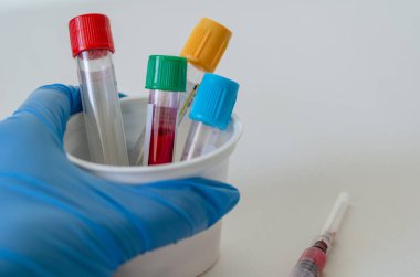 Beyaz arka planda kan örnekleri var..