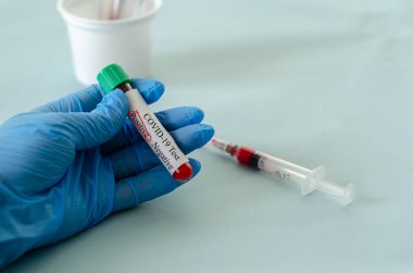 Laboratuvarda kan testi tüpleri, kan örnekleri, kovid 19 test kan örneği, kavramsal görüntü..