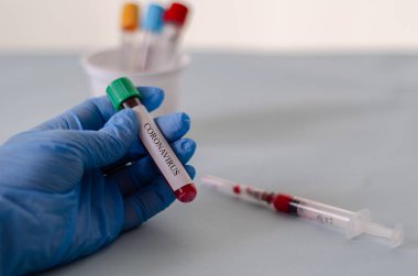 Laboratuvarda kan testi tüpleri, kan örnekleri, kovid 19 test kan örneği, kavramsal görüntü..