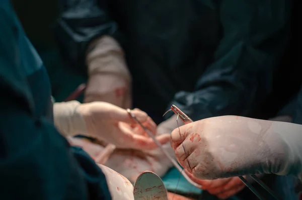Cirugía Histerectomía Médico Cirujano Masculino Enfermeras Operación —  Fotos de Stock