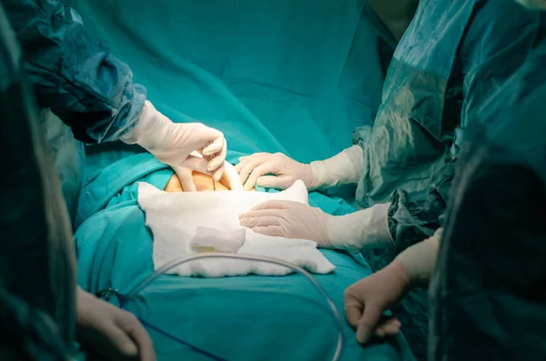 Cirujano Está Operando Paciente Quirófano Hospital — Foto de Stock