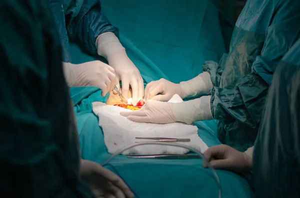 Cirujano Seguro Está Operando Paciente Quirófano Hospital —  Fotos de Stock