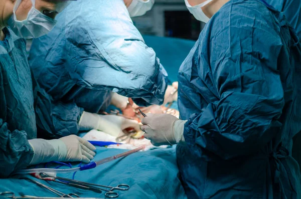 Cirujano Está Operando Cuidadosa Concentradamente —  Fotos de Stock