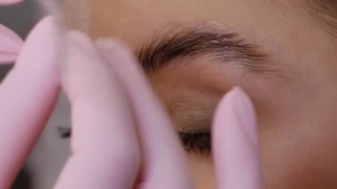 Kaş kaplama prosedürü