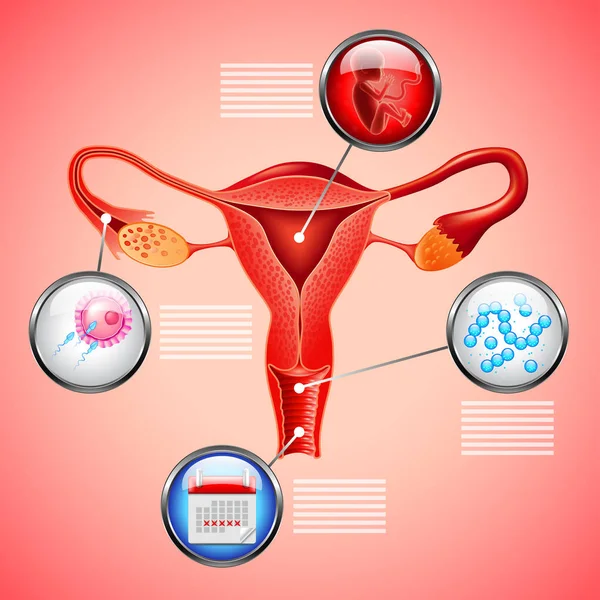 Infografica con utero e altri oggetti su sfondo vettoriale rosso — Vettoriale Stock