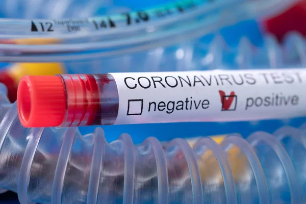 2019-nCoV in Wuhan, China. virus Coronavirus blood test in Laboratory Coronavirus test list medical form