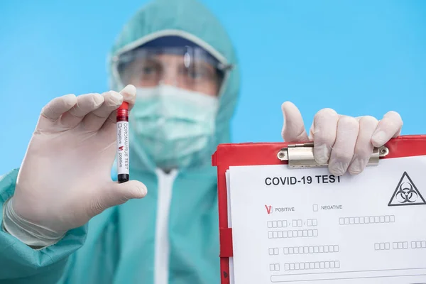 Coronavirus COVID 19 nCov Salgını. Hastanın yeni Corona Virüs Kan Tüp 'ü. Korona virüsü Avrupa, İtalya, Wuhan, Çin. Salgın ve Salgın Enfeksiyon