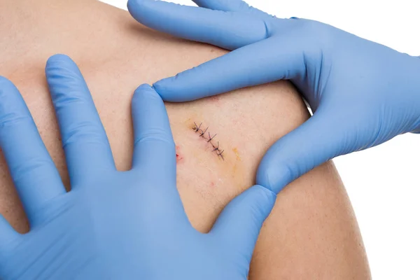 Plastic surgery doctor hands framing stitched incision