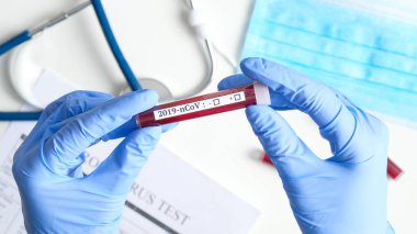 Hemşire 2019 ncov analizi için test tüpünü kanla tutuyor. Çin Koronavirüsü kan testi konsepti. Virüs enfeksiyonu Çin, Wuhan 'dan kaynaklanıyor.