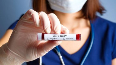 Hemşire 2019 ncov analizi için test tüpünü kanla tutuyor. Çin Koronavirüsü kan testi konsepti.