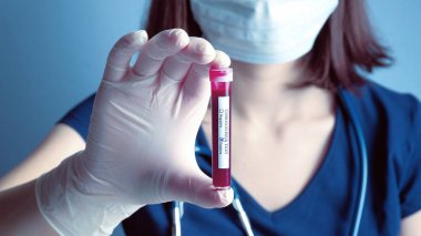 Doctor wearing respirator mask holding in hand positive Coronavirus blood test result. 2019-nCoV biochemical blood analysis in laboratory. Chinese Wuhan virus outbreak
