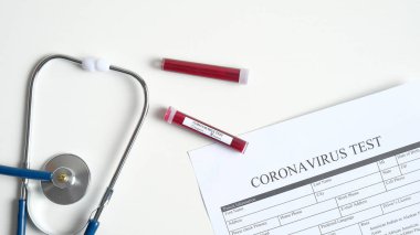Coronavirus kan testi konsepti. Coronavirus testli laboratuvar masası, kan tüpleri, stetoskop. 2019-ncov Coronavirus kökenli Wuhan, Çin