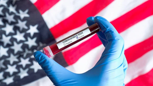 Coronavirus outbreak in USA concept. Nurse hand in gloves holding test tube with blood over flag of the United States of America. Blood test for Novel Chinese Coronavirus 2019-nCoV — Stock Photo, Image