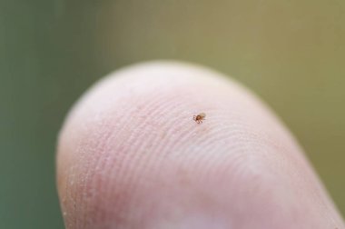 İnsan parmağının ucunda sürünen minik kene perisi. Parazitler, beyin iltihabı, lyme hastalığı, aşı ve sağlık konseptleri.