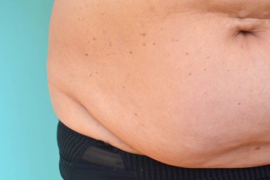 Kadın göbeği. Aşırı kilo sorunları. Sağlıklı yaşam tarzı konsepti. Obezitenin arkaplanı