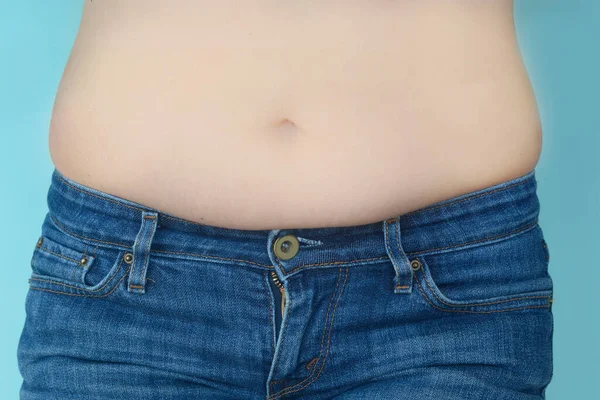 Pancia femminile. Problemi di peso in eccesso. Concetto di stili di vita sani. Antecedenti dell'obesità — Foto Stock