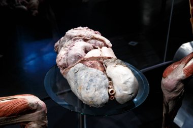 Body Worlds Müzesi