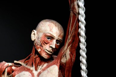 Plastinated insan vücudu