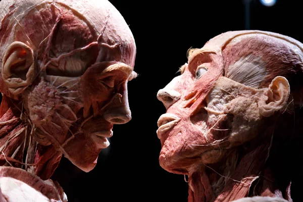 Body Worlds Exhibition — Stock Photo, Image