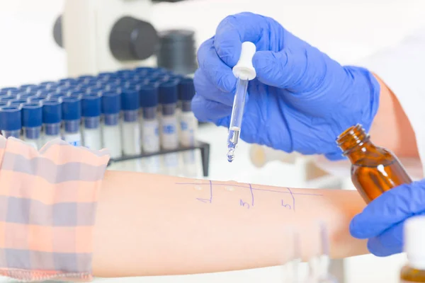 Алергічні тести в лабораторії — стокове фото