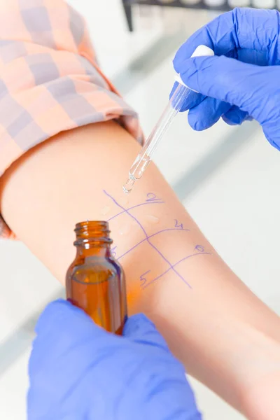 Allergy tests in laboratory — Stock Photo, Image