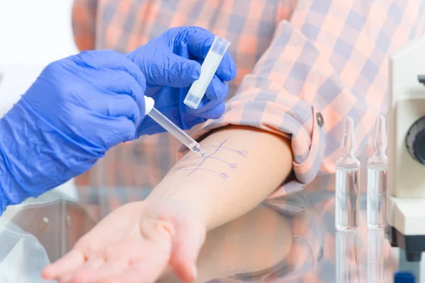 Allergy tests in laboratory — Stock Photo, Image