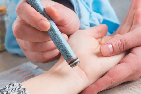 Therapist doing moxa treatment — Stock Photo, Image