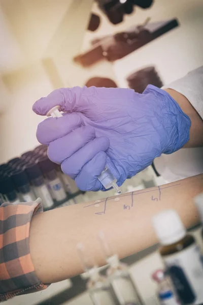 Test allergologici in laboratorio — Foto Stock