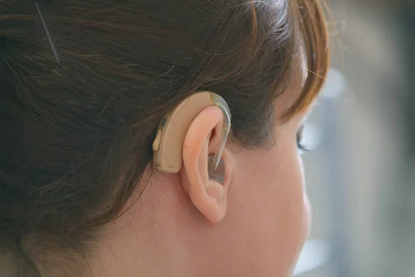 Глуха жінка в слуховому апараті — стокове фото