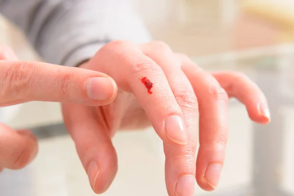 Dedo sangrando, mão com uma ferida — Fotografia de Stock
